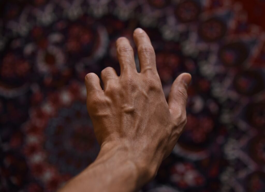 warts on hands