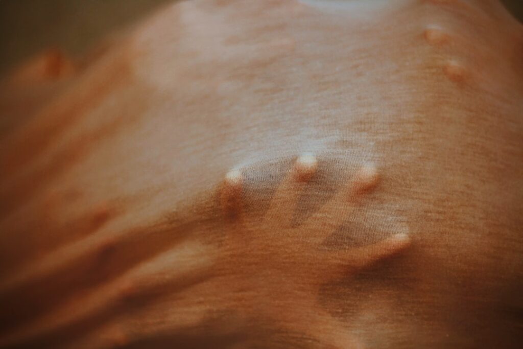 flesh colored skin tags