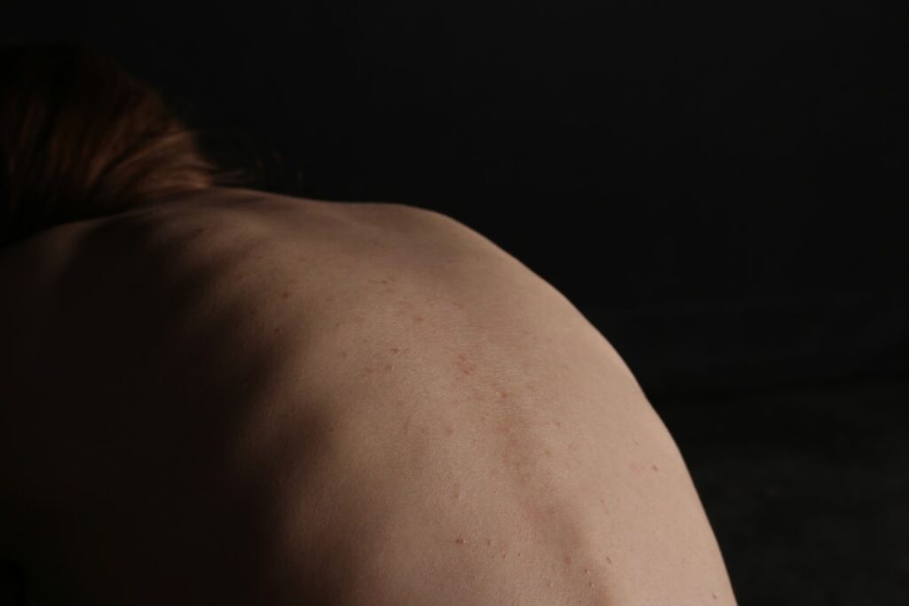 do skin tags grow back