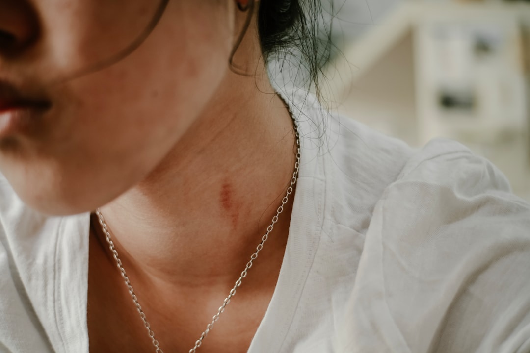 neck skin tags