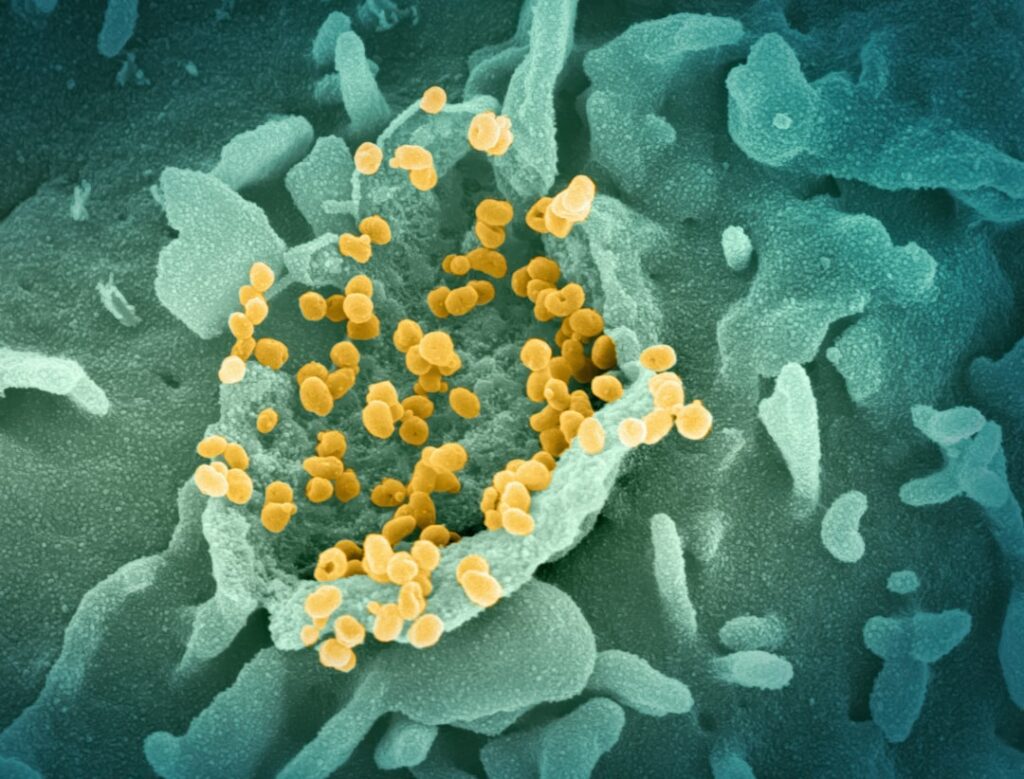 human papillomavirus infection