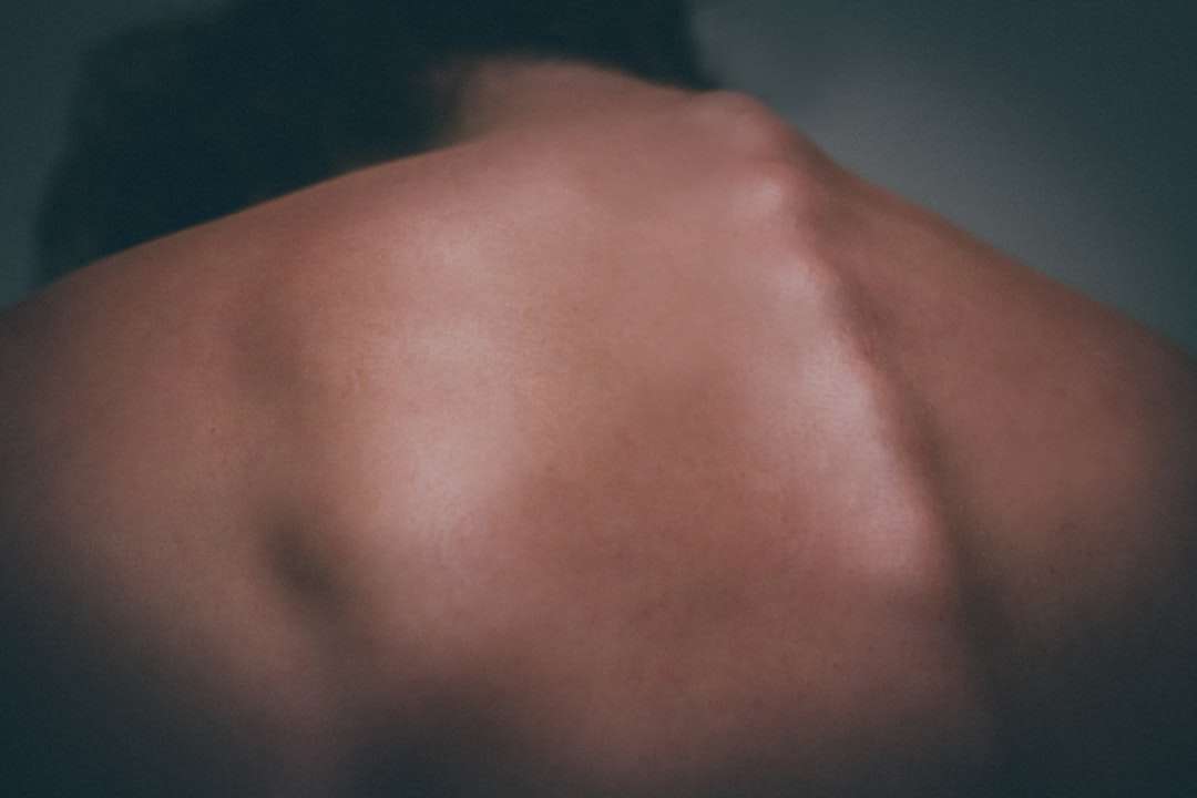 do skin tags grow back