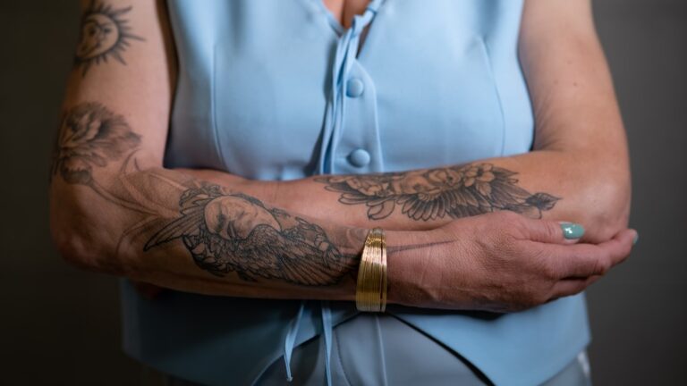 cryotherapy skin tags